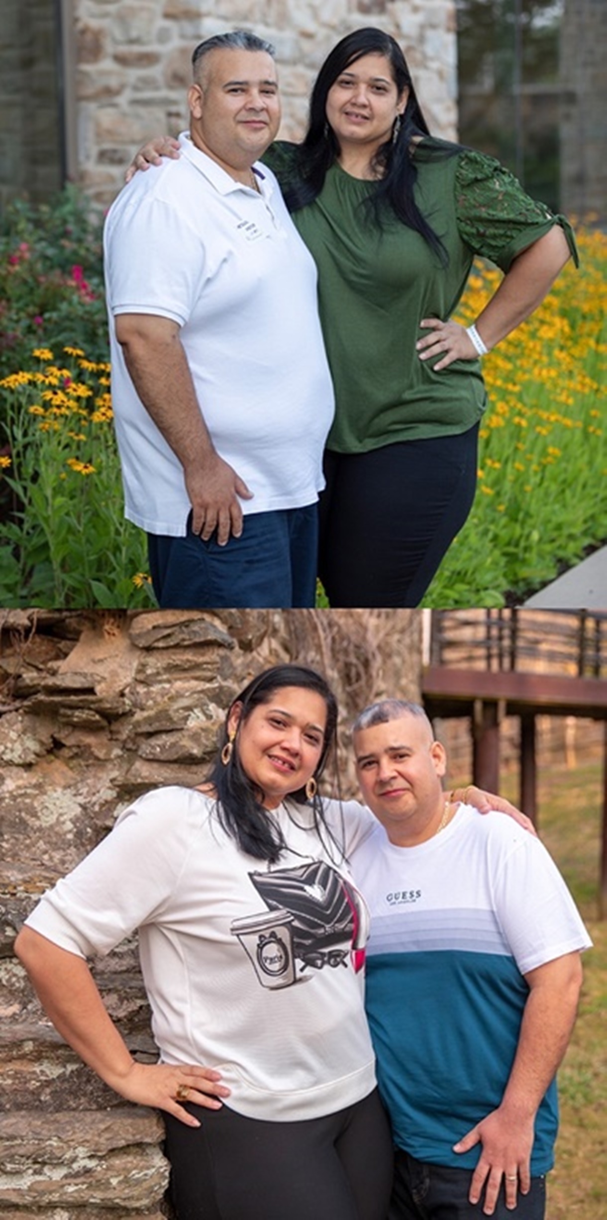 Diana's and Aumary's Weight Loss Surgery Story